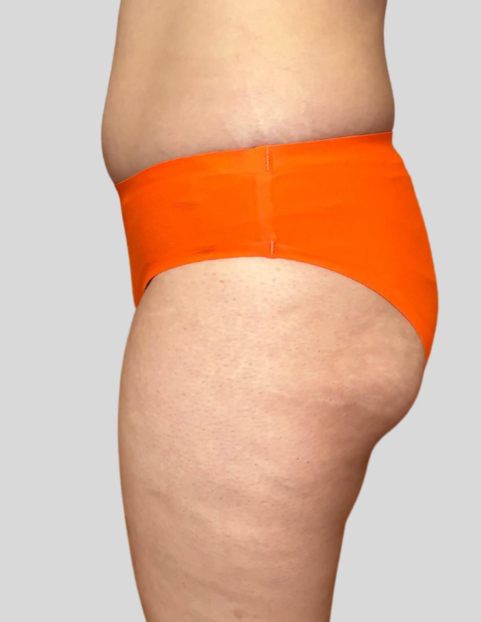 Bikini a la cadera para mujer